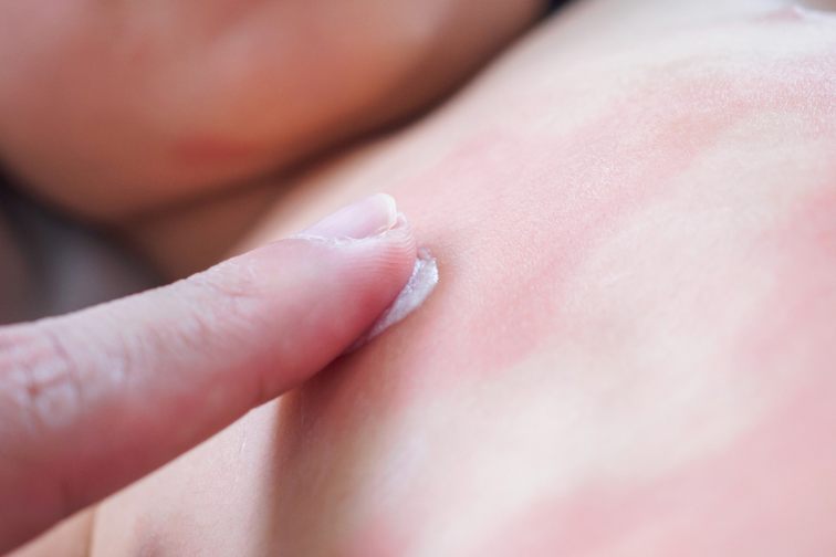 osip kod beba po stomaku